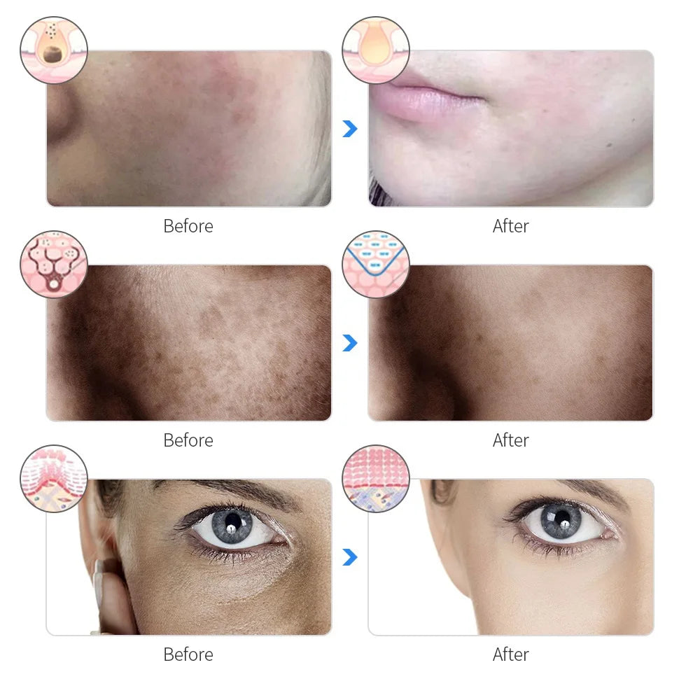 Roseora GlowMask Pro – 7 Color LED Skin Therapy Mask